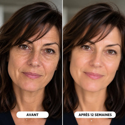 Une peau plus ferme et plus lisse en quelques jours, et non en quelques semaines.