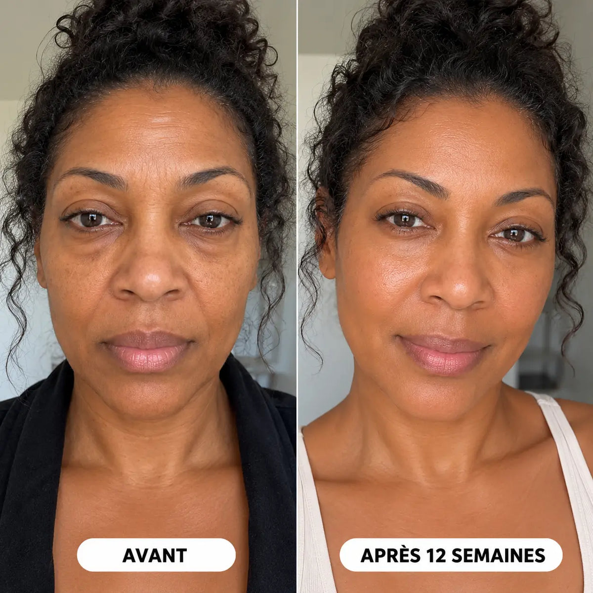 Une peau plus ferme et plus lisse en quelques jours, et non en quelques semaines.