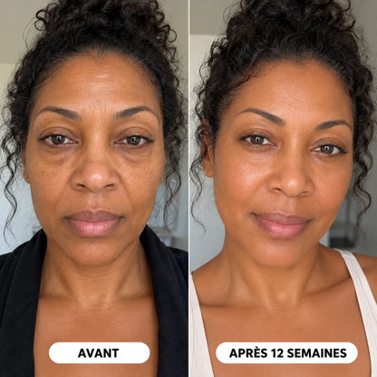 Une peau plus ferme et plus lisse en quelques jours, et non en quelques semaines.