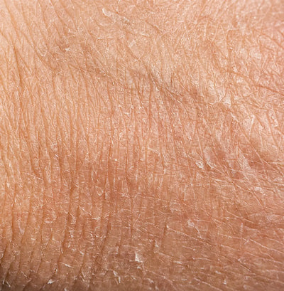 Sécheresse